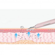 Anlan Ultrasonic Skin Scrubber (pink) 4